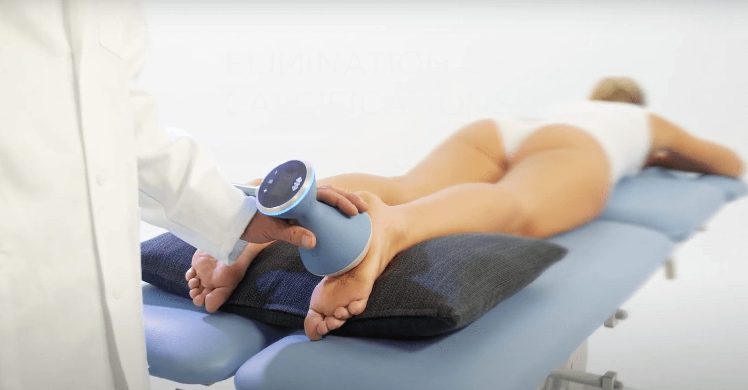 Focused Shock Wave Therapy done on Plantar fascia