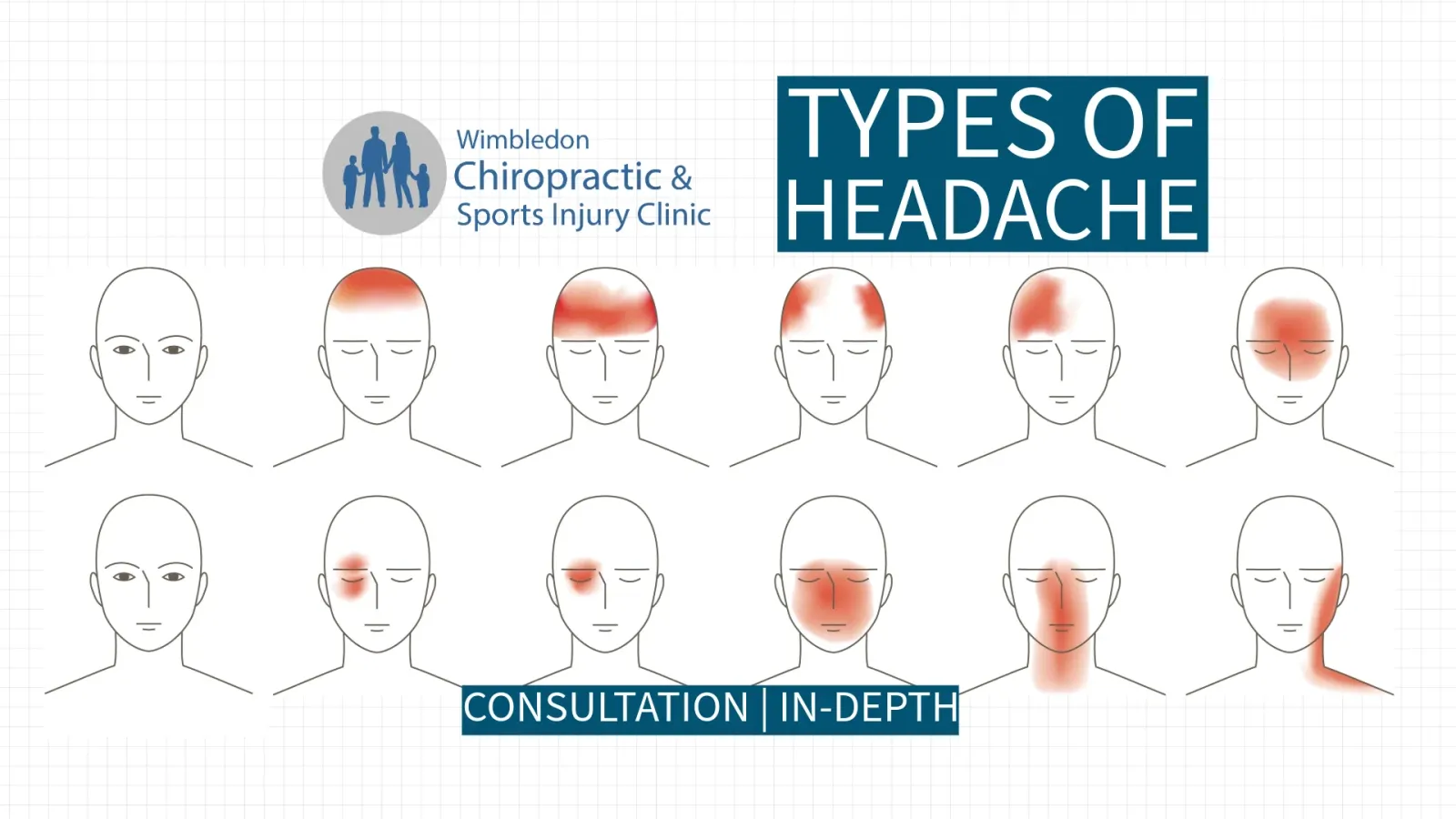 migraine-headache-treatment-in-wimbledon-london-sw19