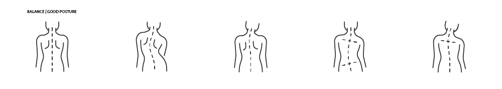 scoliosis treatment types at wimbledon chiropractic and sports injury clinic